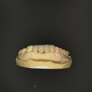 뉴치과기공소 이미지