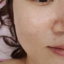 사과나무스킨케어 네이버블로그