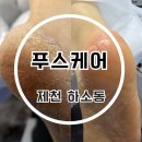제천 롯데마트 푸스케어 발각질 관리