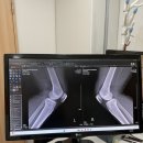 의료법인 가창삼성의료재단 | 은평구정형외과 체외충격파 무릎통증 정확한 원인 진단 성누가병원