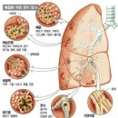 소리없이 스며드는 `라돈`의 공포 이미지