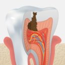 서울오브치과병원 | 자연치아를 지키는 힘, 서울오브치과병원의 보존치료 철학