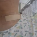 일산연세의원 | 일산차병원 갑상선암 수술 후기