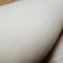 피부의정석