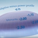 비전옵틱스 이미지