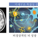 조현병 초기 원인 정신분열증 가능성 이미지