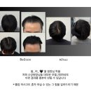 꿀오토샵 | 대구 두피문신 수강학원 선택하는 기준