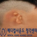 소이메디칼 네이버블로그