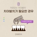 청담플란트치과의원 네이버블로그