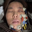 정진한의원 | 구안와사 초기 일주일 치료 후기 (전조증상, 신경과, 한의원, 회복템)