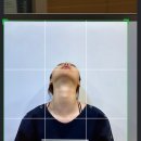 이병철한의원 | 한의원 턱관절치료 스플린트 구강내균형장치 표준형균형장치와 맞춤형균형장치 효과