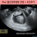 [9w] 좋은문화병원 전원+초진후기