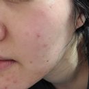 별고운빛의원 이미지