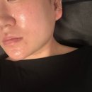 에벤에셀 피부 앤 왁싱 | 상인동 피부관리 에벤에셀피부앤왁싱 대구이혈테라피하는곳 방문후기