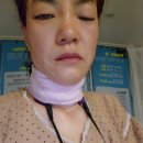 셀프건강 셀프닥터 | 50대 여성 구안와사 자가치료 방법 실제 사례 - 라라코리아 라라소닉(권진영라라샵)