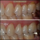 부마치과 이미지