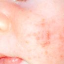 눈꽃피부과의원 이미지