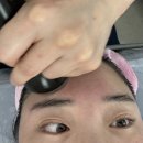 에스테틱 미쁨 | 부산대 윤곽관리로 얼굴 라인 정리! 미쁨에스테틱 후기✨