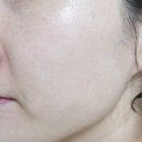 재생크림 비치라이트 센텔라미라클크림 명원국제 더마크림 사용후기