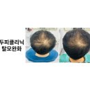 레드우드하라힐즈 네이버블로그