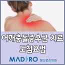 어깨통증 원인 어깨충돌증후군 치료법 도침요법 이미지