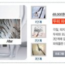 웰킨두피탈모센터울산삼산점