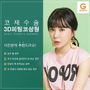 글로비성형 네이버블로그