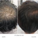 반하는 홍헤어#