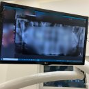 서울바른치과의원 | [강동구/천호역]내돈내산 퇴근후 방문하기 좋은 강동구 치과 ㅣ서울바른강치과의원 강동천호점