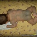 몽고반점 이미지