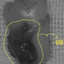 이하루치과의원 이미지