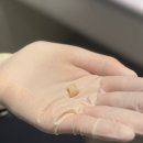 M치과기공소 이미지