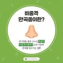 비중격만곡증이란??? 이미지