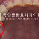 동암플란트치과의원 이미지