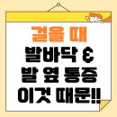 송정속시원내과의원 | 걸을 때 발바닥 통증, 발 옆 통증 원인 및 치료방법 총정리 (+자가관리법)