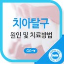 정 치과보존과 치과의원 이미지