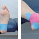 더튼튼한의원 이미지