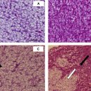 어류의 지방간 (fatty liver) 이미지