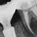 뿌리깊은 이정근치과의원 이미지