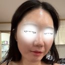 은하스킨앤바디 | [개포동 피부관리] 은하스킨앤바디 모공타이트닝 후기 ✨