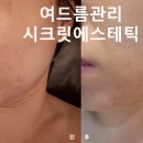 하단동1079 | 부산 사하구 피부관리 잘 하는 시크릿에스테틱 여드름관리 후기