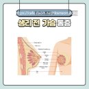 생리 전 가슴통증을 없애는 방법이 있을까요? 이미지
