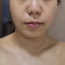 메이킹(making) | [2동탄피부관리] 메이킹뷰티 방문 후기: 물방울 리프팅으로 완성하는 광채 피부 (웨딩/신부관리 추천)