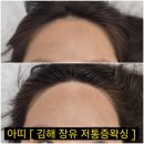 김해장유 깔끔한 왁싱은? •아띠• 헤어라인 후기