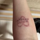 제이유의원 | [울산 제이유의원] 울산 문신제거 타투제거 솔직후기 (5회차)