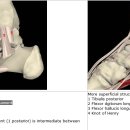 Kleiger test -＞ ankle deltoid ligament검사 이미지