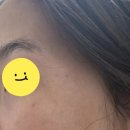 공피부과의원 | 이수역 피부과 쥬베룩 스킨 후기