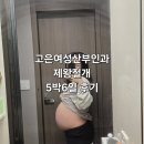 고은여성병원 | 고은여성산부인과 제왕절개 5박6일 후기 1일차