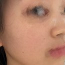 휴메디컬안산영업소 | [안양호계동피부관리샵] 📍스킨리벨럽 ㅣ 안양피부관리/신부관리/트러블케어/피부