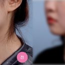 강남더슬림의원 이미지